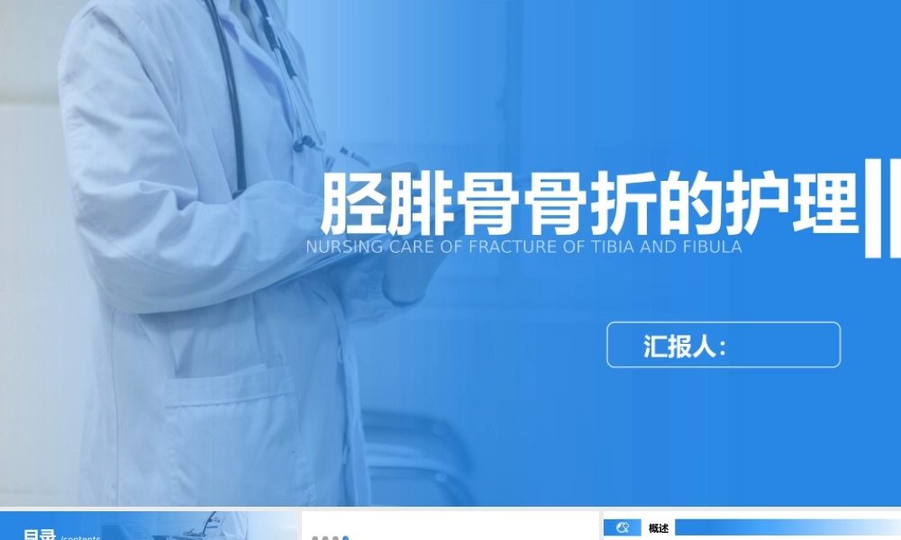 胫腓骨骨折护理查房