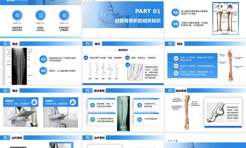 胫腓骨骨折护理查房