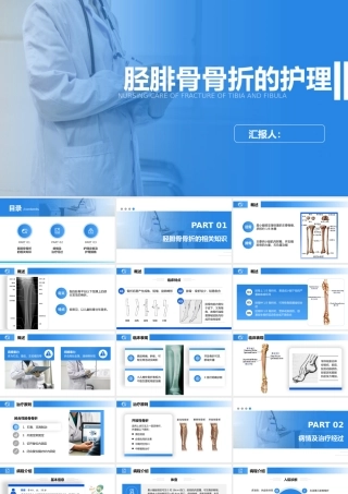 胫腓骨骨折护理查房