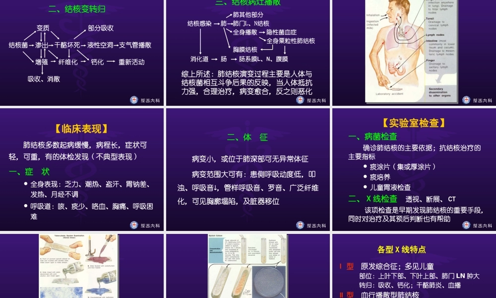 肺结核完整课件