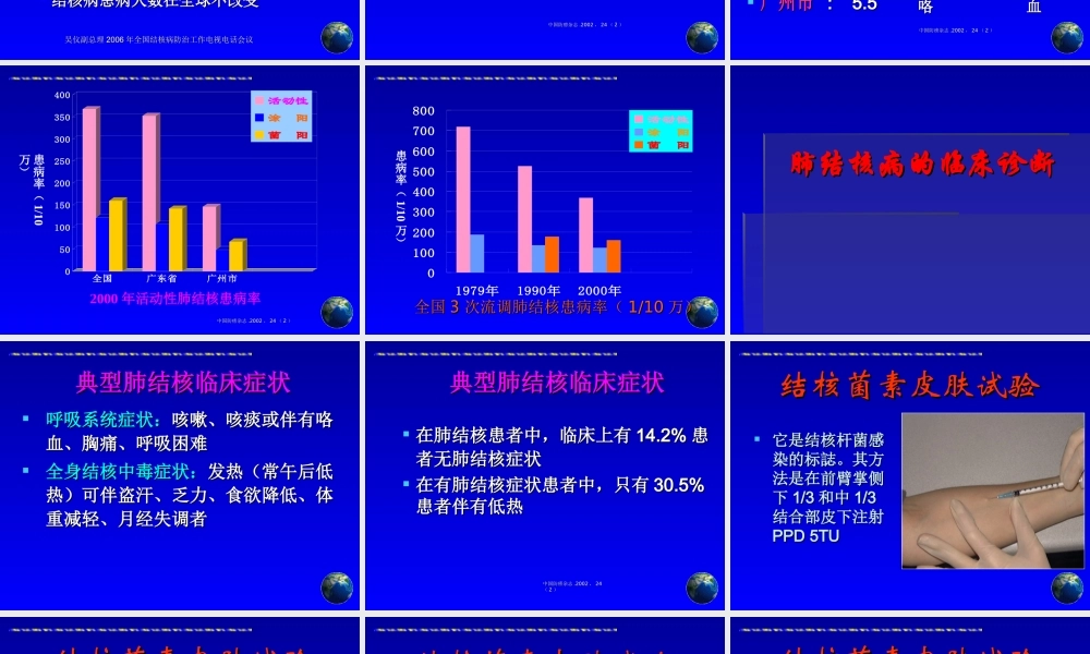 肺结核诊断和治疗进展