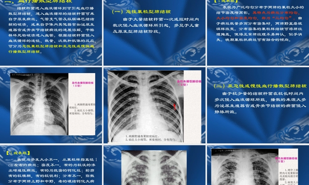 肺结核课件完整