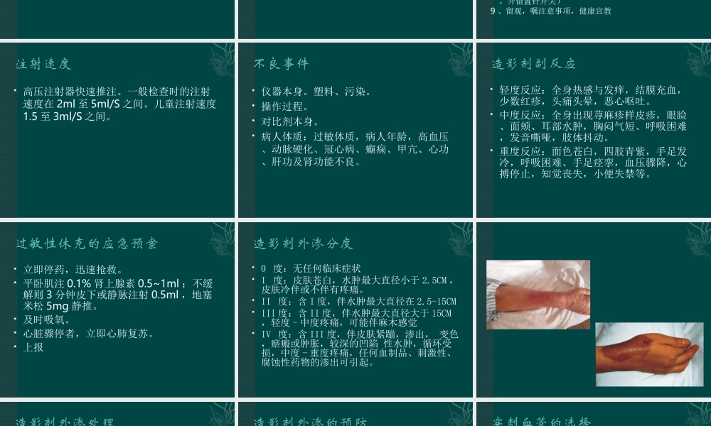 CT增强注意事项