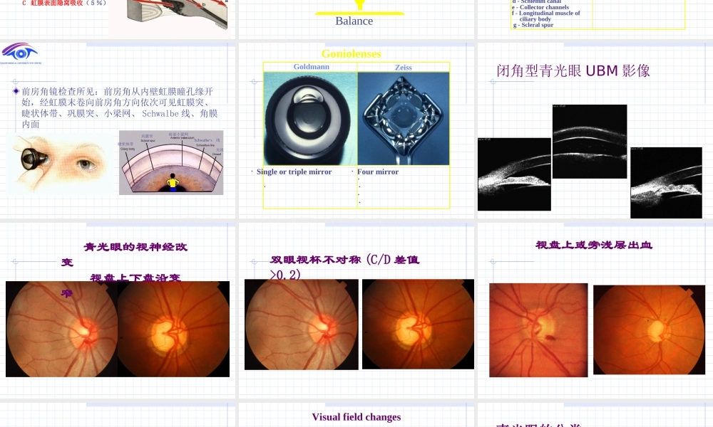 临床知识_眼科学_课件_青光眼
