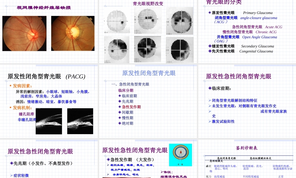临床知识_眼科学_课件_青光眼
