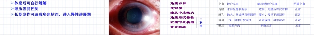 临床知识_眼科学_课件_青光眼