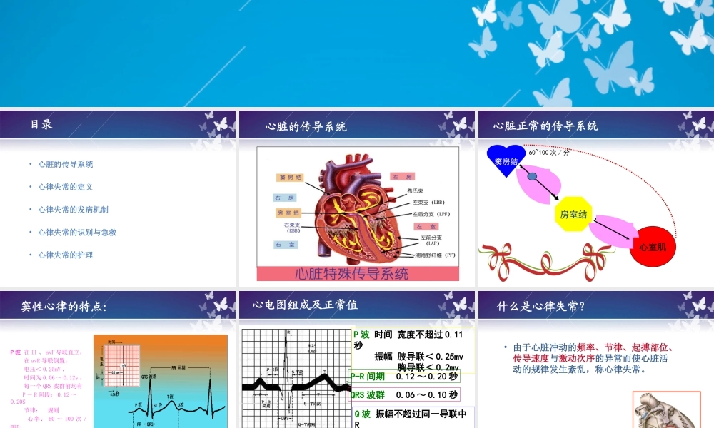 常见心律失常的观察与护理)