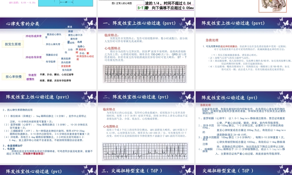 常见心律失常的观察与护理)