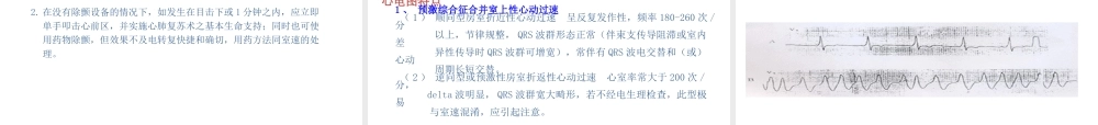 常见心律失常的观察与护理)