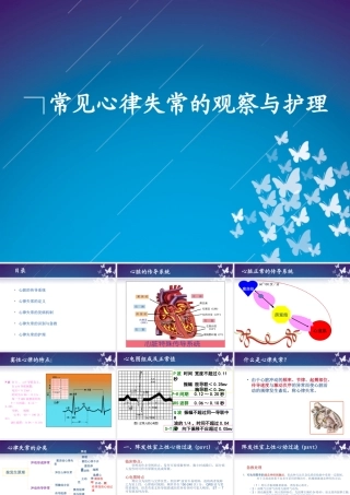 常见心律失常的观察与护理)