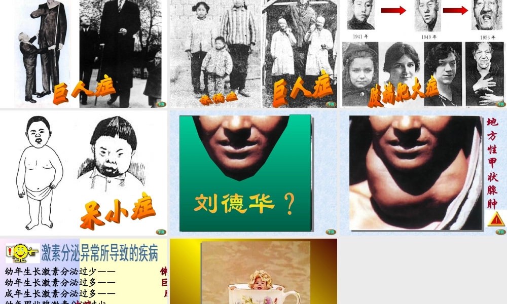 七年级生物下册激素调节课件新人教版 课件