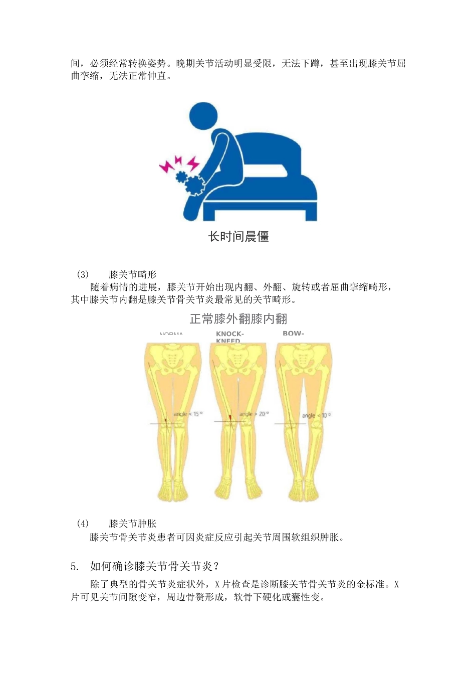 膝关节骨关节炎的阶梯治疗_第3页