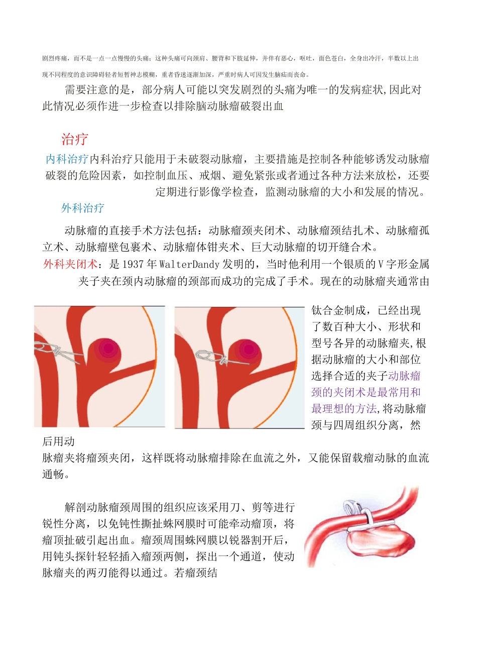 脑动脉瘤的概述与治疗_第3页