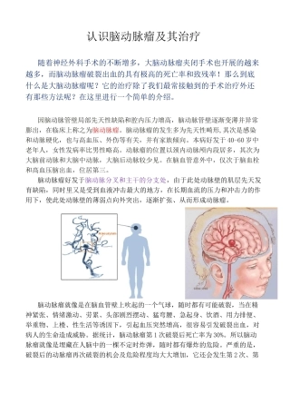 脑动脉瘤的概述与治疗