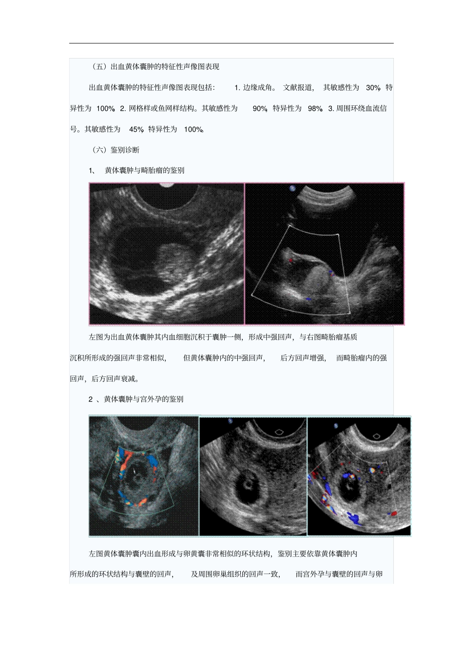 卵巢病变超声诊断实习_第3页