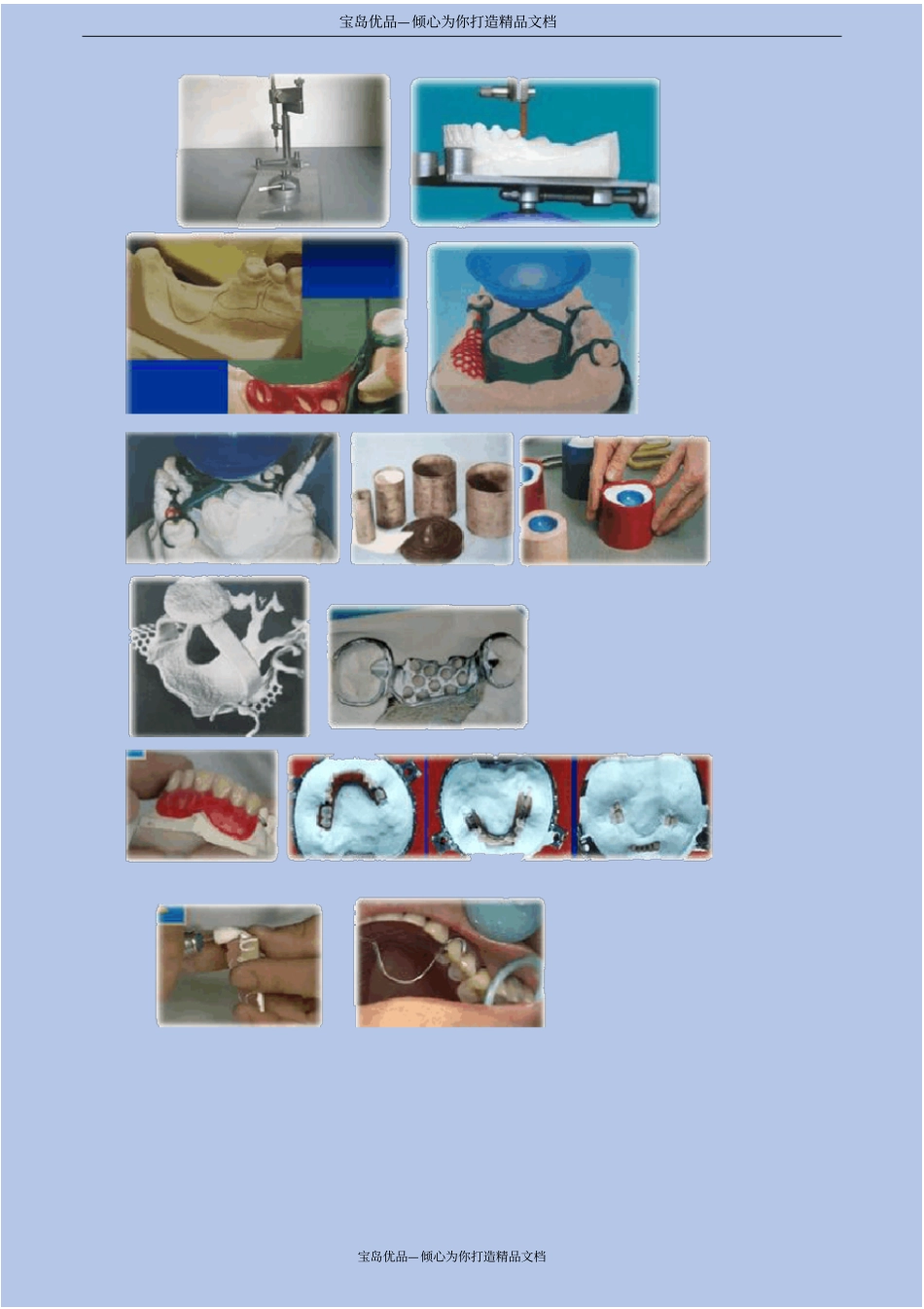 口腔修复学——牙列缺损修复_第3页