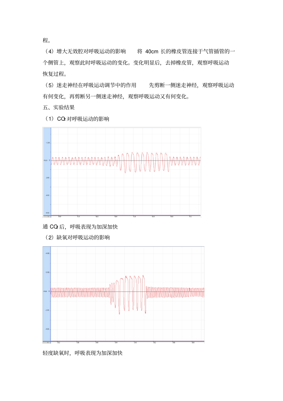 呼吸运动的调节试验报告_第2页