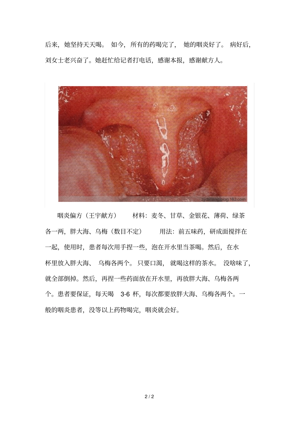 咽炎偏方简直太神啦_第2页