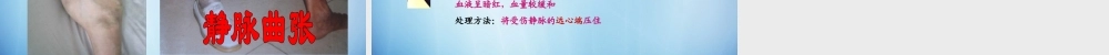 中学七年级生物下册 第四章 第二节 血流的管道-血管课件 (新版)新人教版 课件