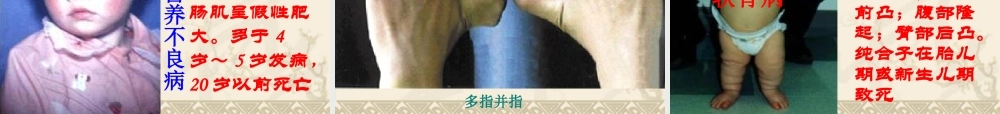 基因的显性和隐性 八年级生物下第二章生物的遗传和变异 第三节 基因的显性和隐性课件人教版 八年级生物下第二章生物的遗传和变异 第三节 基因的显性和隐性课件人教版