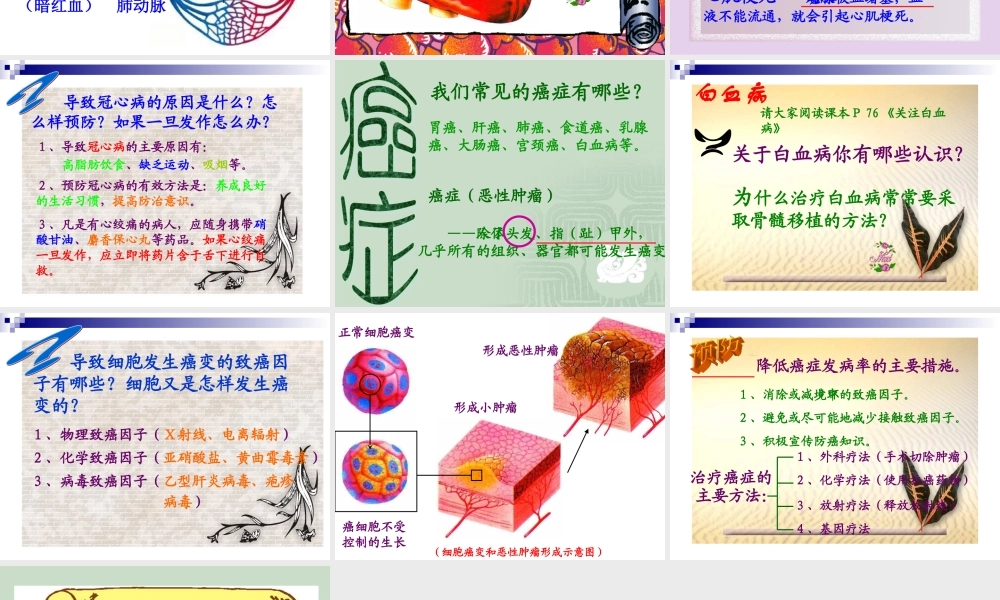 威胁健康的主要疾病 八年级生物上第18章第2节威胁健康的主要疾病课件苏教版 八年级生物上第18章第2节威胁健康的主要疾病课件苏教版