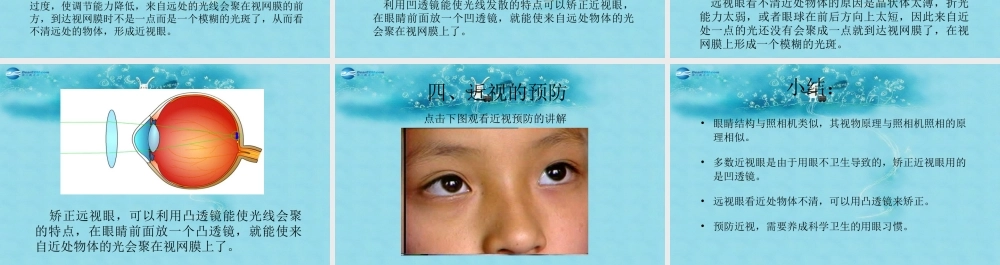 八年级物理上册 5.4 眼睛与眼镜课件 (新版)新人教版 课件