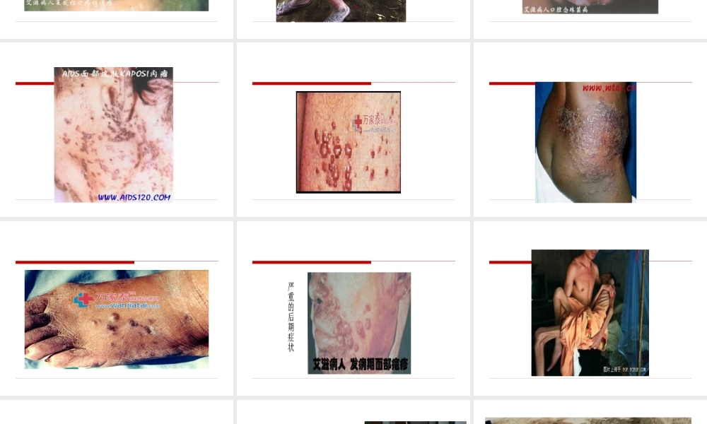 艾滋病防治知识主题班会