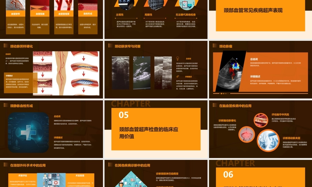 颈部血管超声检查通用课件