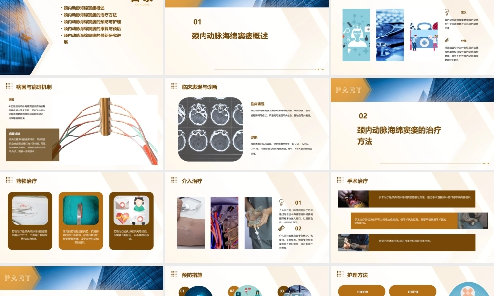 颈内动脉海绵窦瘘讲课课件