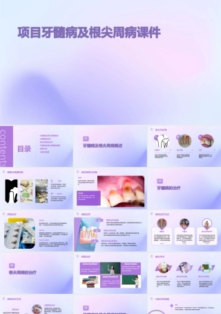 项目牙髓病及根尖周病课件