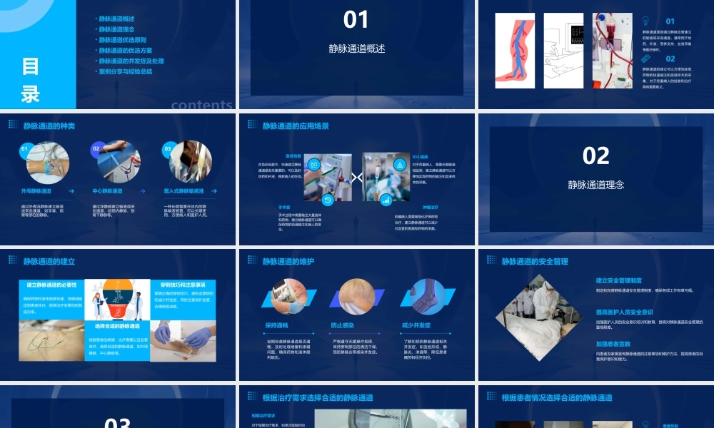 静脉通道理念与优选课件