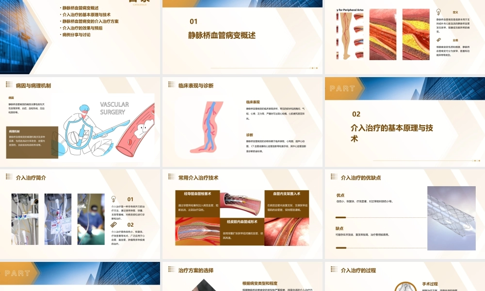 静脉桥血管病变的介入治疗课件