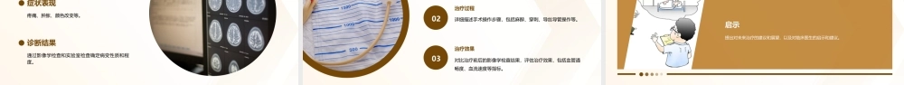 静脉桥血管病变的介入治疗课件