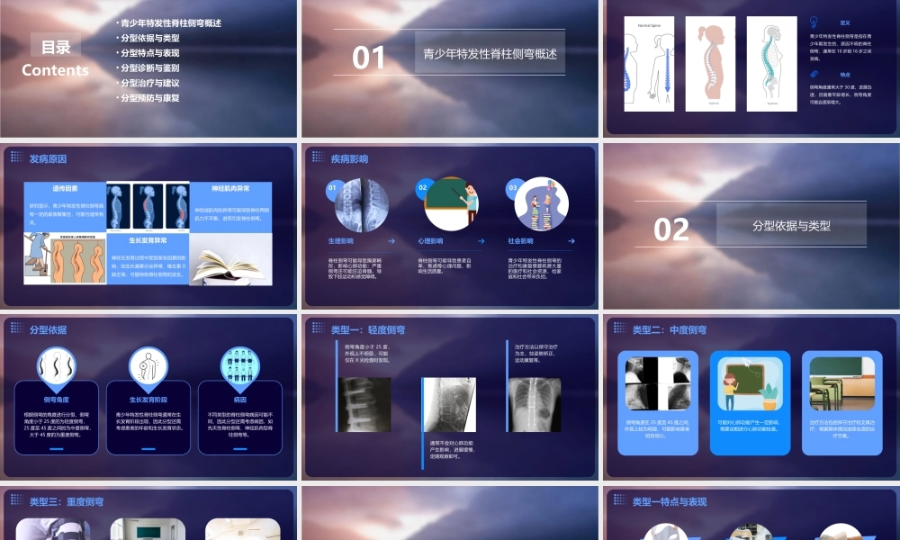 青少年特发性脊柱侧弯的分型课件