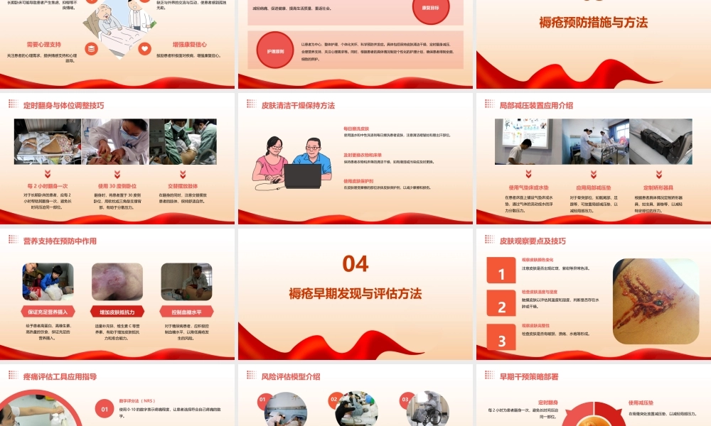 长期卧床患者的褥疮预防与护理