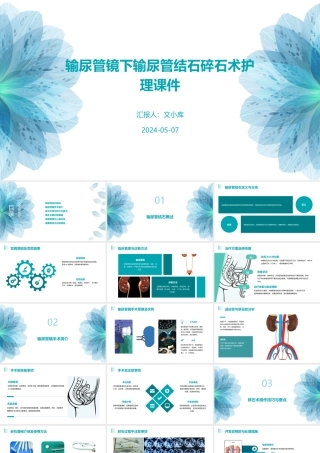 输尿管镜下输尿管结石碎石术护理课件