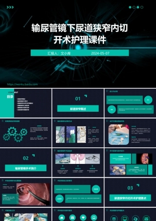 输尿管镜下尿道狭窄内切开术护理课件