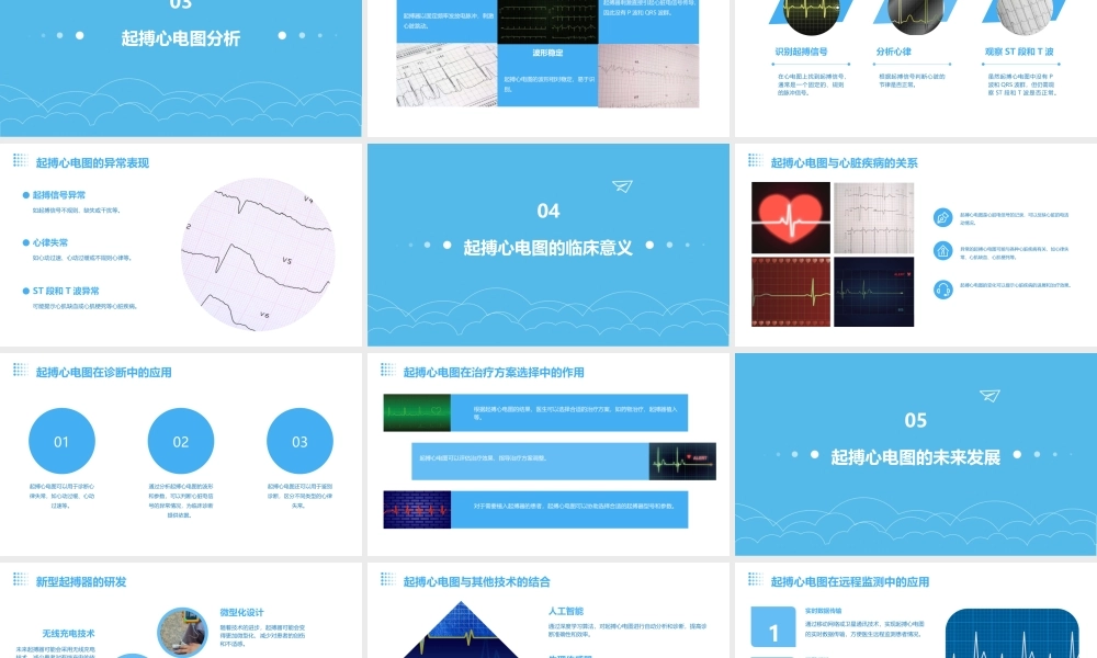 起搏心电图的分析通用课件
