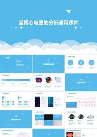 起搏心电图的分析通用课件