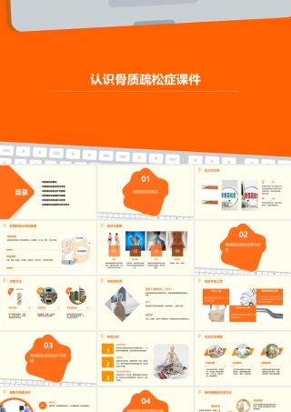 认识骨质疏松症课件