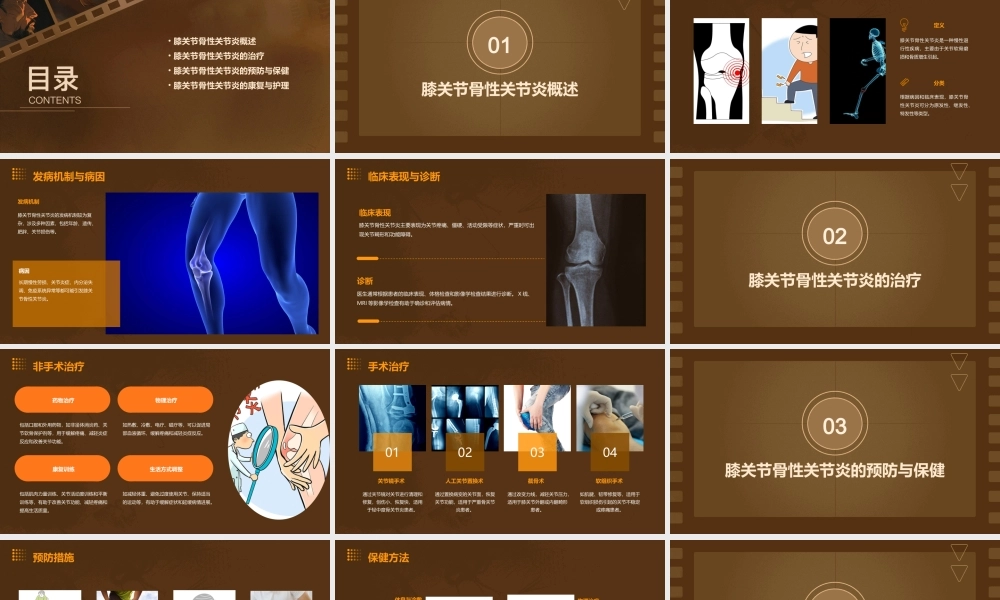 膝关节骨性关节炎资料课件