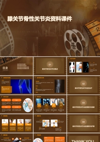 膝关节骨性关节炎资料课件