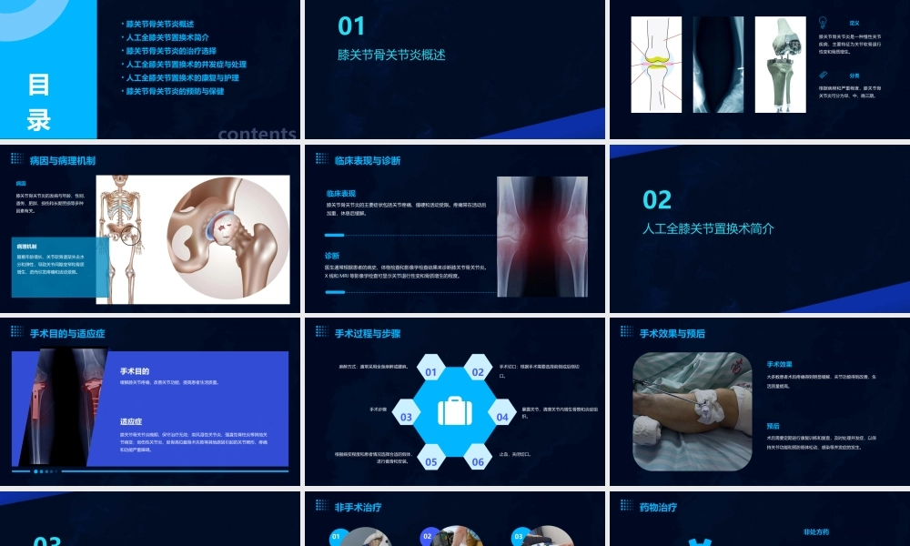 膝关节骨关节炎与人工全膝关节置换术罗强课件