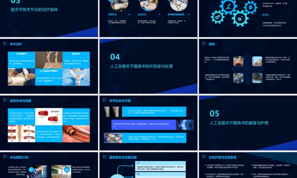 膝关节骨关节炎与人工全膝关节置换术罗强课件
