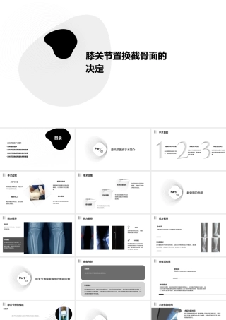 膝关节置换截骨面的决定课件