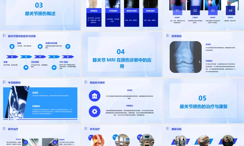 膝关节MRI解剖及损伤课件