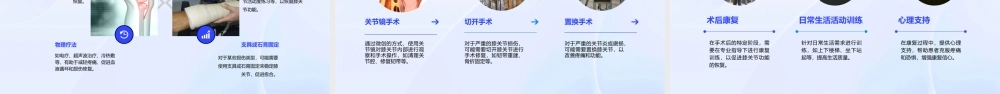 膝关节MRI解剖及损伤课件