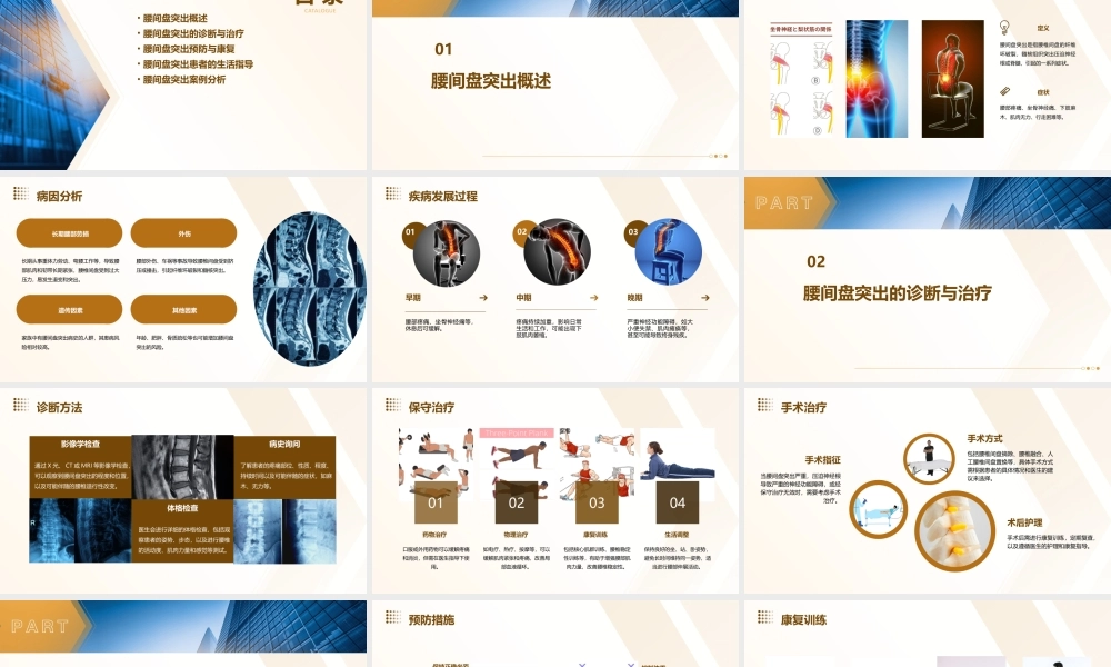 腰间盘突出分析课件