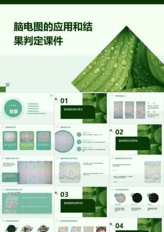 脑电图的应用和结果判定课件