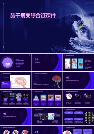 脑干病变综合征课件